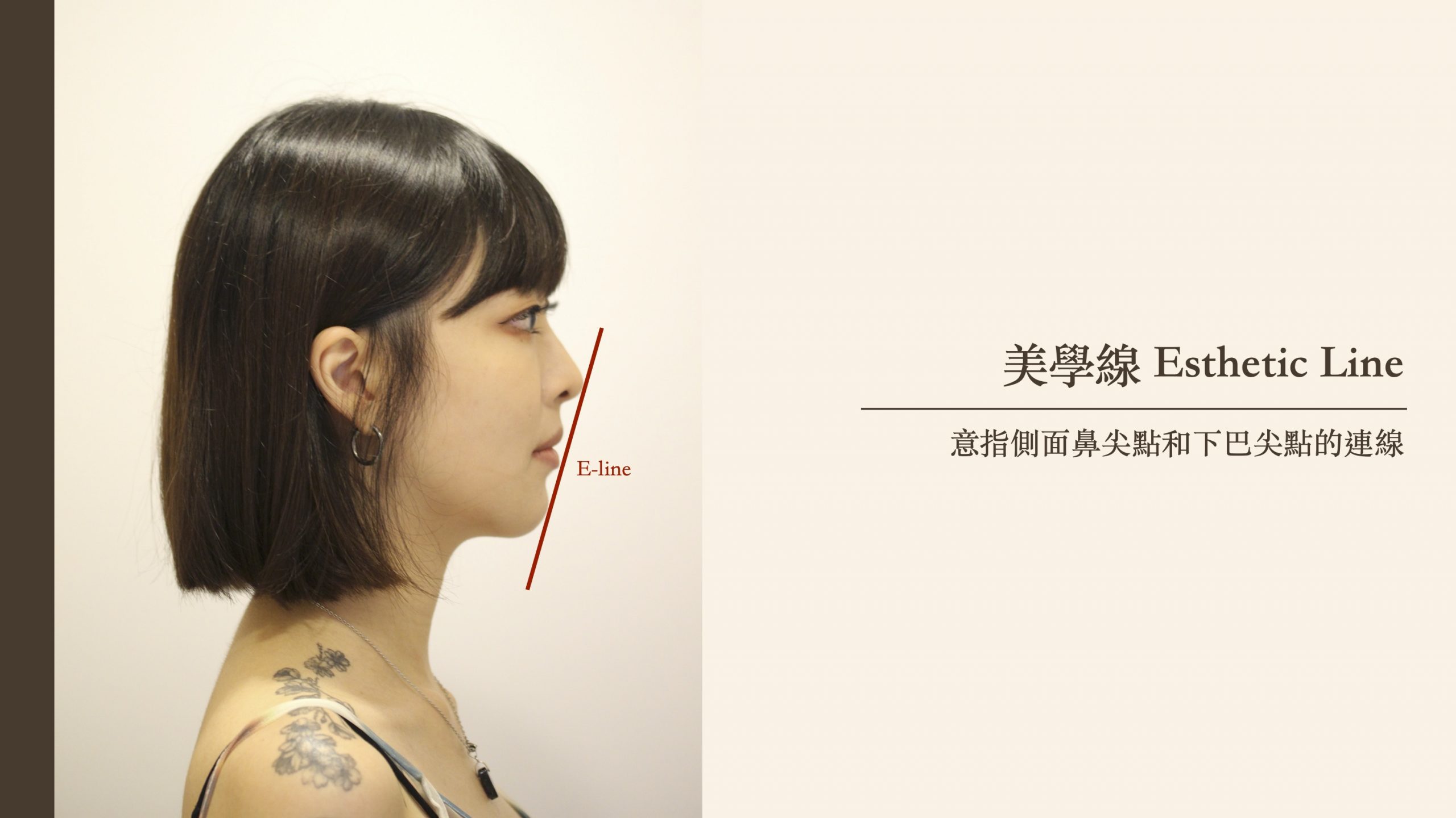 釐清2大常見暴牙原因